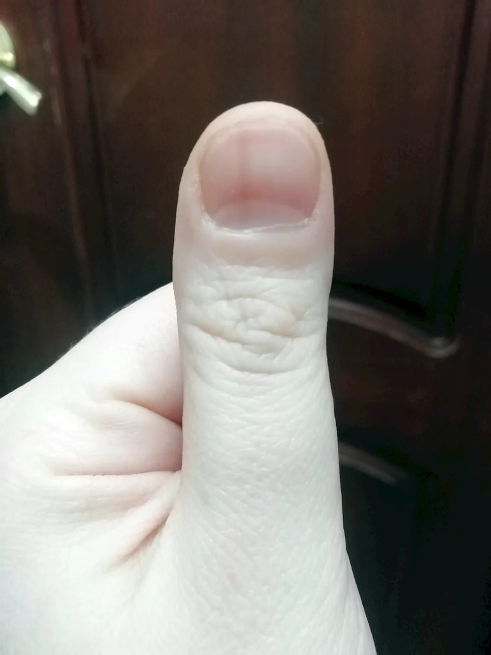 Черная полоска на ногте большого пальца