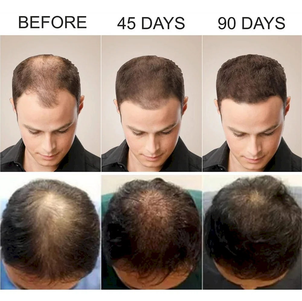 Hair growth products