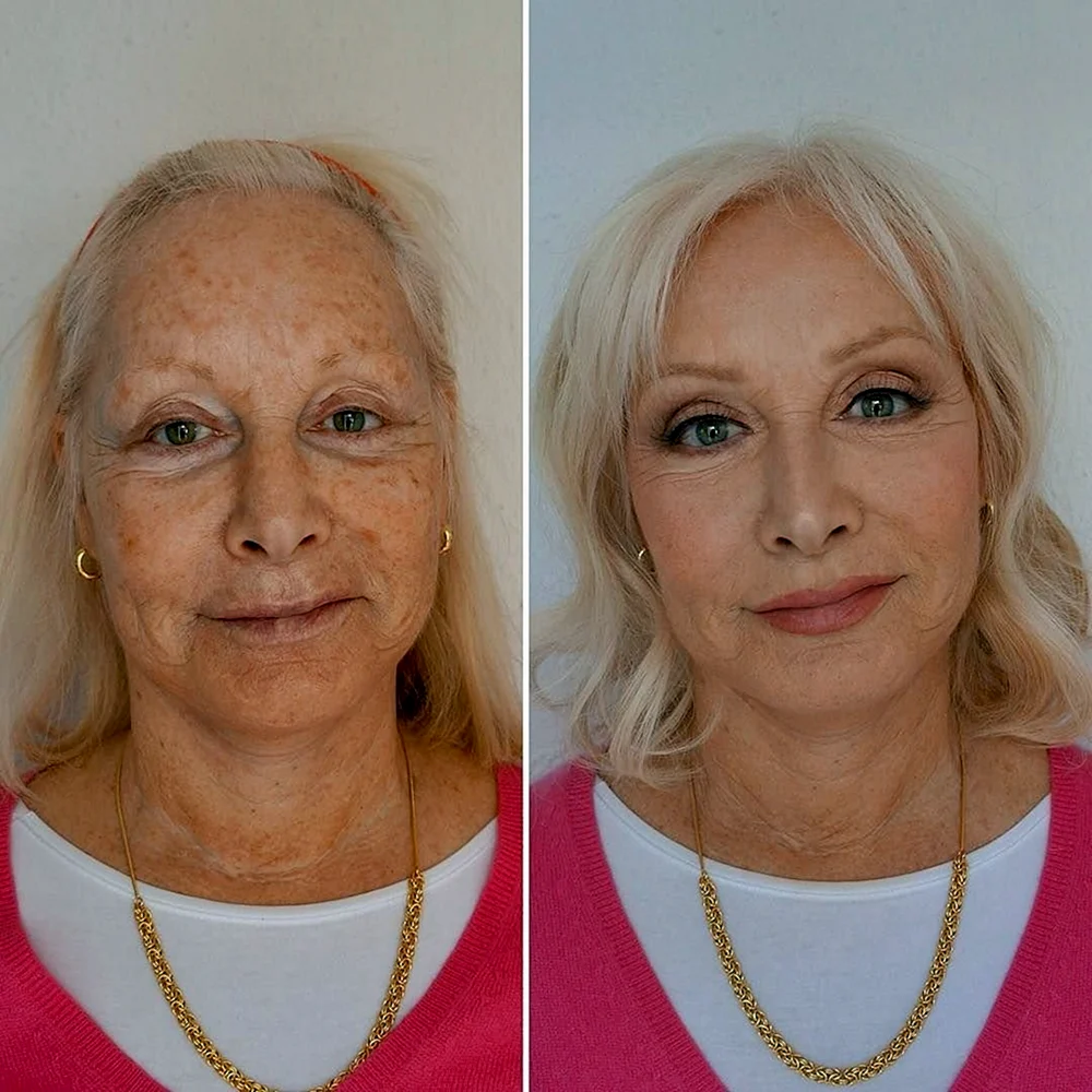 Old woman before after