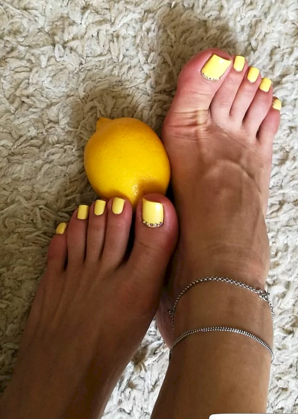 Yellow Nails feet